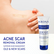 Load image into Gallery viewer, Krona  Scar Removal Cream For Old Scars -Stretch Mark Removal Cream for Men and Women