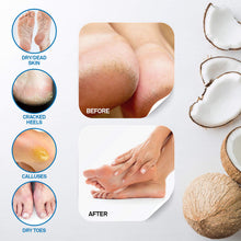 Load image into Gallery viewer, KRONA Coconut Foot Peel Mask- Safe &amp; Natural - Perfect Foot Mask For Men &amp; Women, 2 Packs