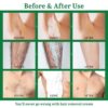 Hair Removal Cream for Women and Men - Leg & Pubic & Bikini Hair Removal Premium Depilatory Cream - Image 7